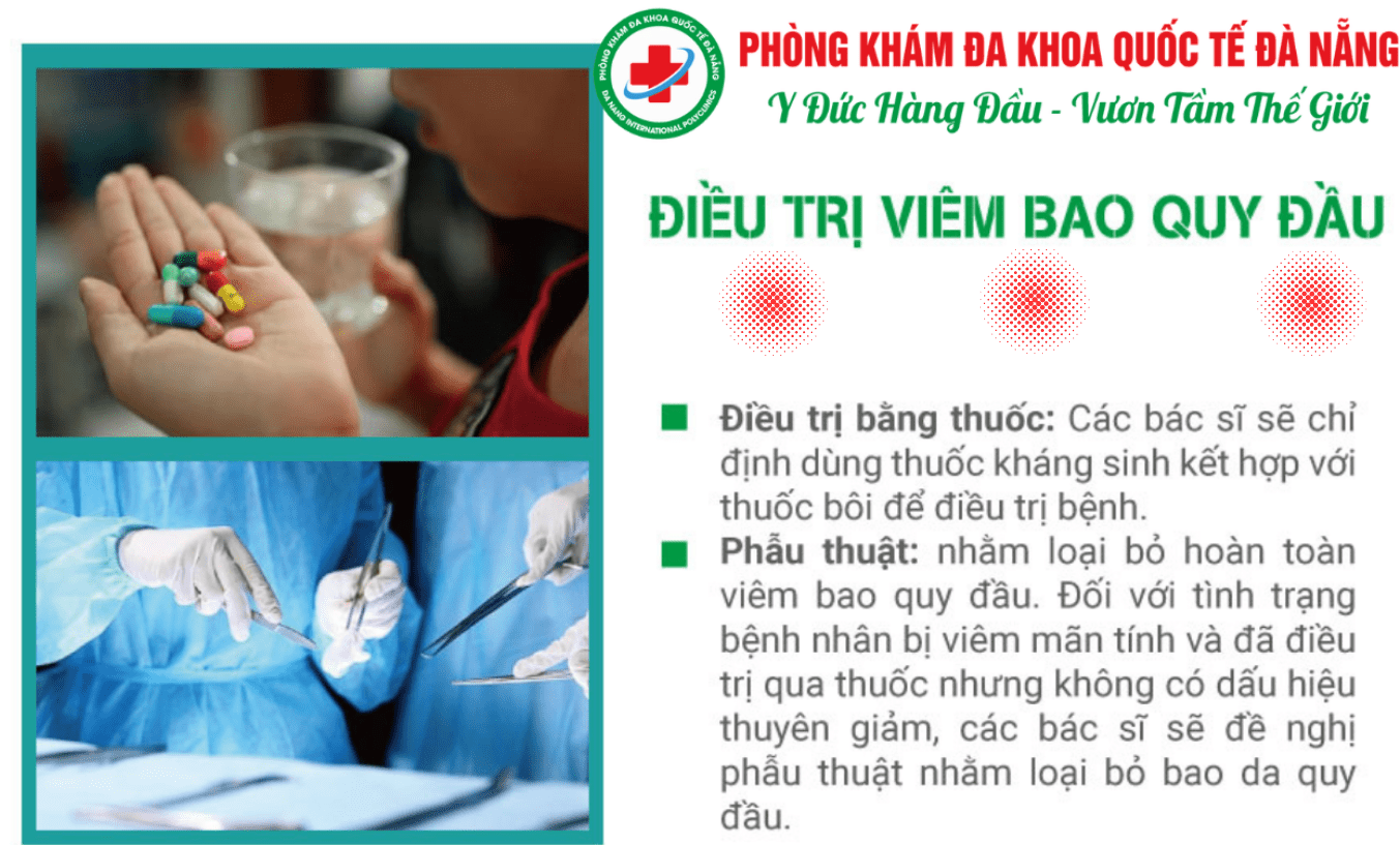 Điều trị viêm bao quy đầu