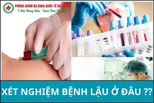 Cơ sở y tế ảnh hưởng trực tiếp đến chi phí xét nghiệm bệnh lậu ở Đà Nẵng
