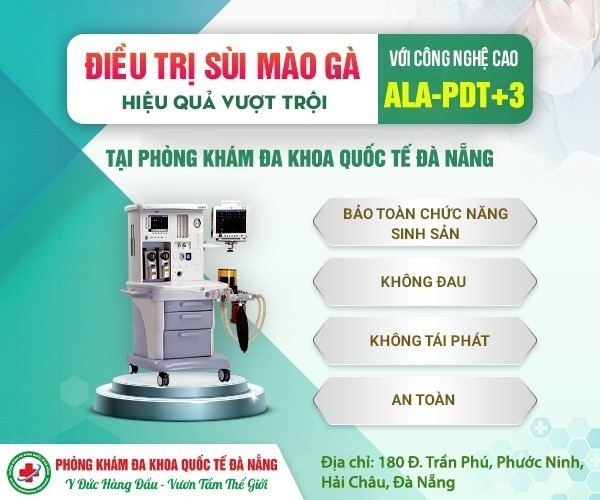 Chữa sùi mào gà ở Đà Nẵng hiệu quả bằng công nghệ ALA-PDT
