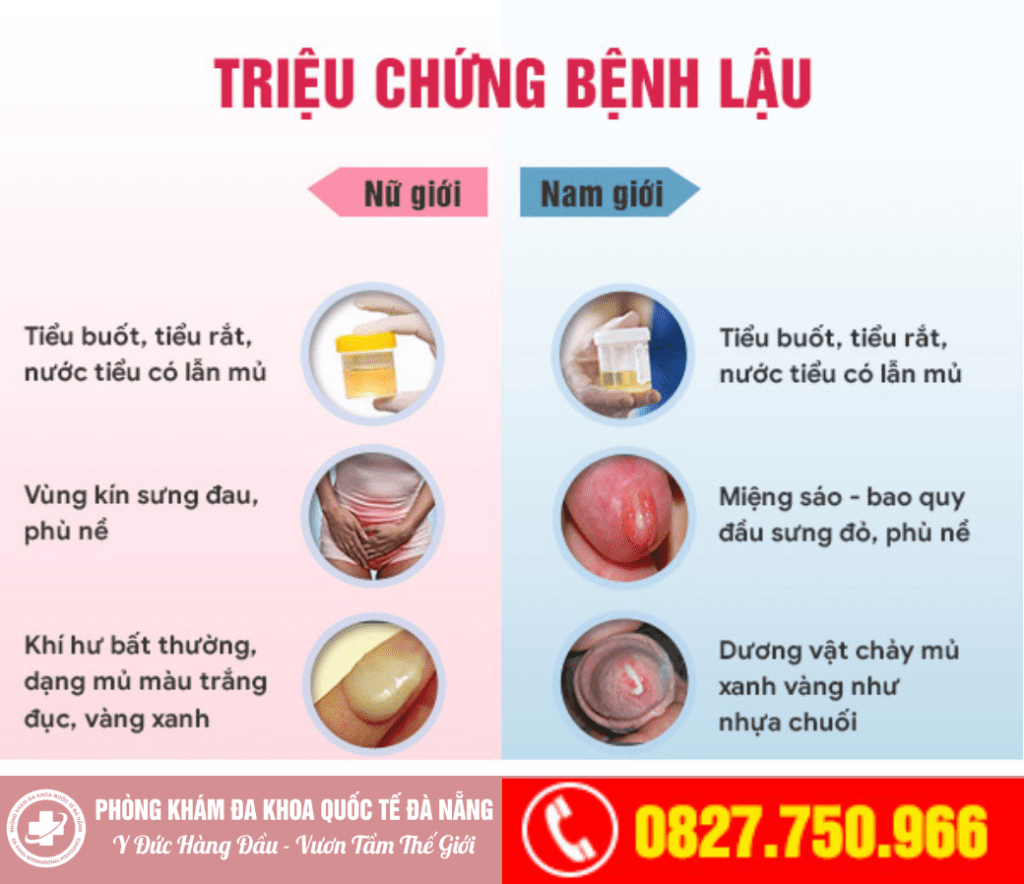 cảnh báo dấu hiệu bệnh lậu