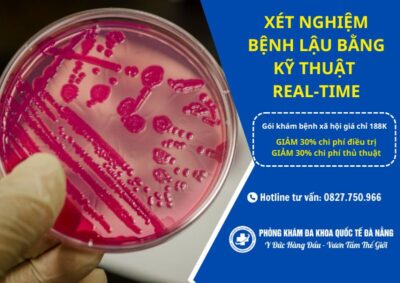 Xét nghiệm bệnh lậu bằng kỹ thuật real time