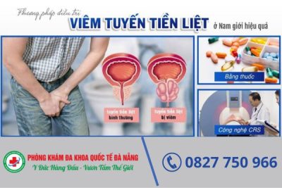 Phương pháp chữa viêm tuyến tiền liệt hiệu quả