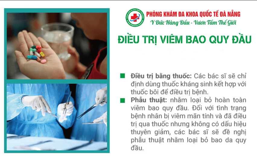 Điều chị viêm bao quy đầu như thế nào?