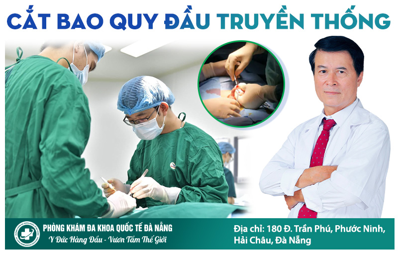 cắt bao quy đầu bằng phương pháp truyền thống