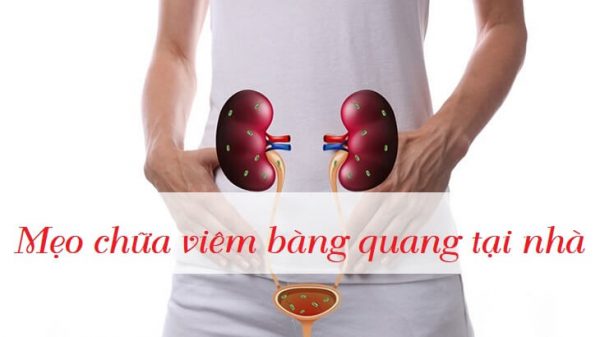 Mẹo chữa viêm bàng quang ngay tại nhà