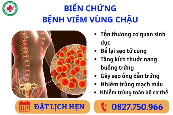 Biến chứng nguy hiểm của bệnh viêm vùng chậu