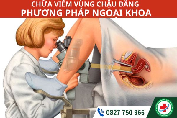 Chữa viêm vùng chậu ở Đà Nẵng bằng phương pháp ngoại khoa