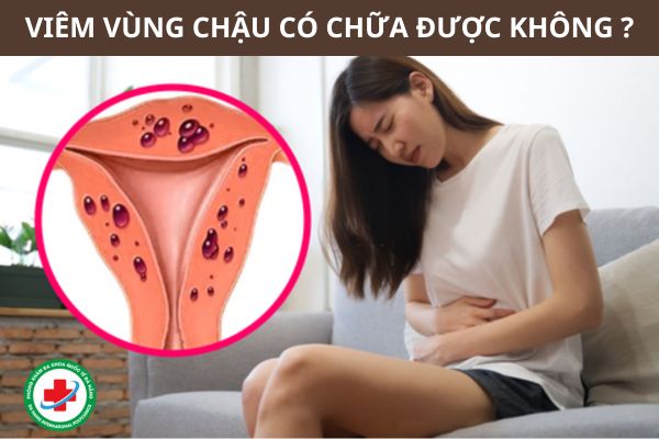 Viêm vùng chậu có chữa được không?