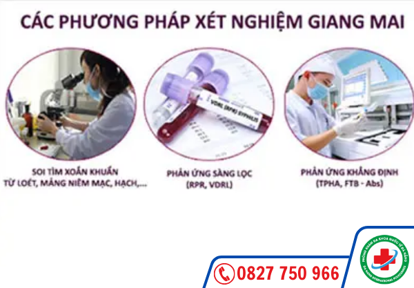 Các phương pháp xét nghiệm giang mai 