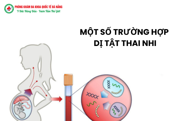 Một số trường hợp dị tất thai nhi có thể bỏ thai