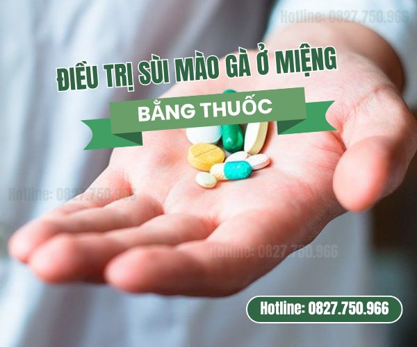 điều trị sùi mào gà bằng thuốc