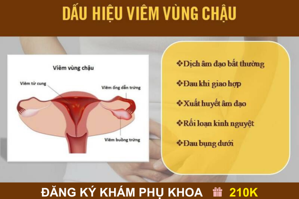 Dấu hiệu viêm vùng chậu