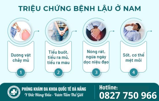 Triệu chứng cảnh báo bệnh lậu ở nam giới