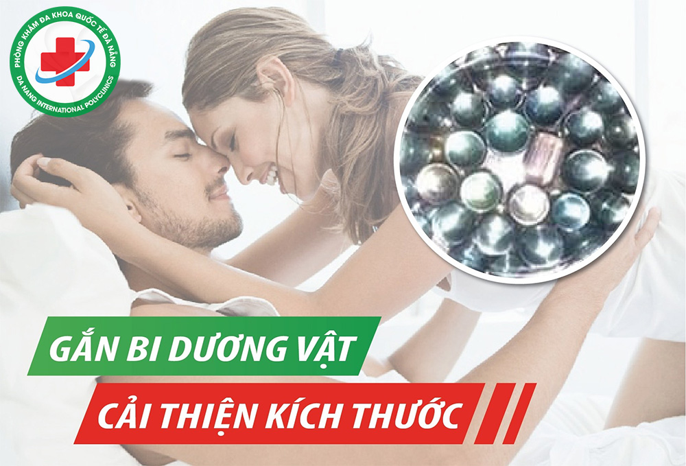 Gắn bi dương vật ở nam giới