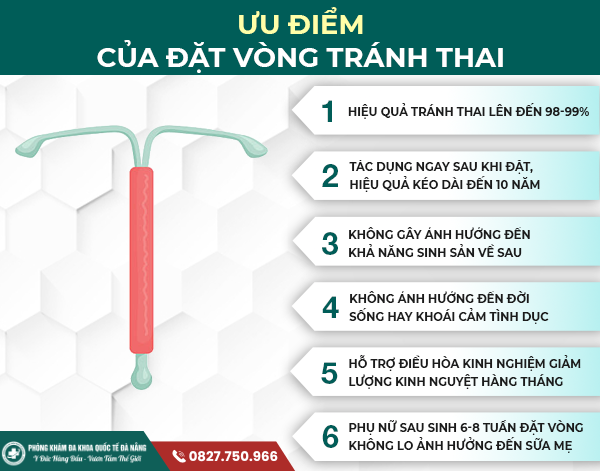 Ưu điểm của vòng tránh thai