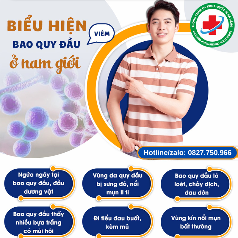 Biểu hiện viêm bao quy đầu ở nam giới