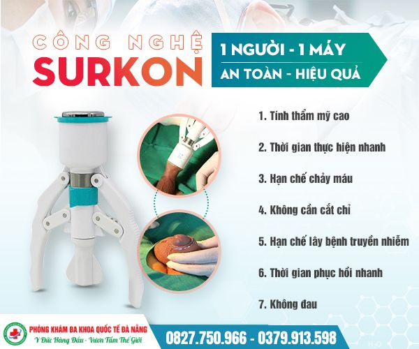Máy Surkon là gì? Vì sao ngày càng nhiều nam giới lựa chọn?