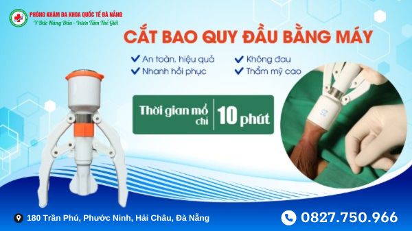 Cắt Bao Quy Đầu Bằng Máy Surkon