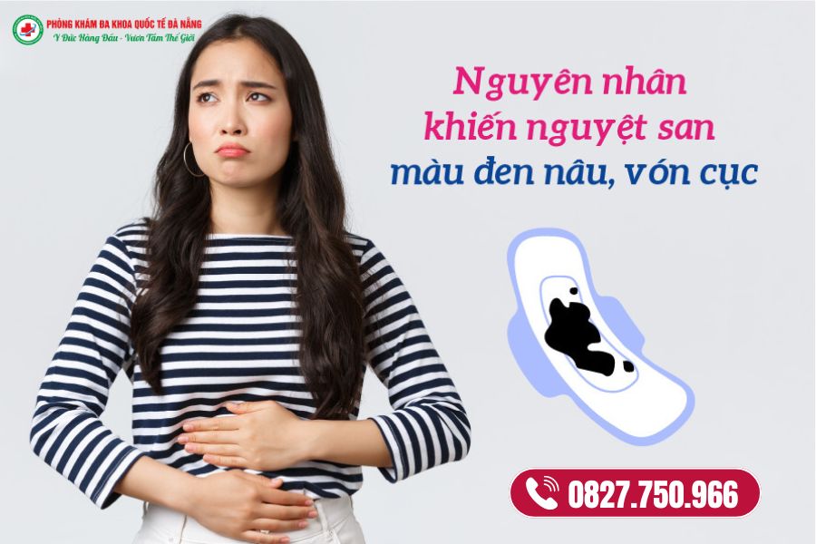 Nguyên nhân gây rối loạn kinh nguyệt ra máu đen
